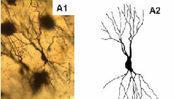 Low acetylcholine - sparse dendrites